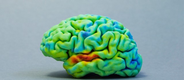 How to: 3D print your own brain using MRI or CT scans & free software