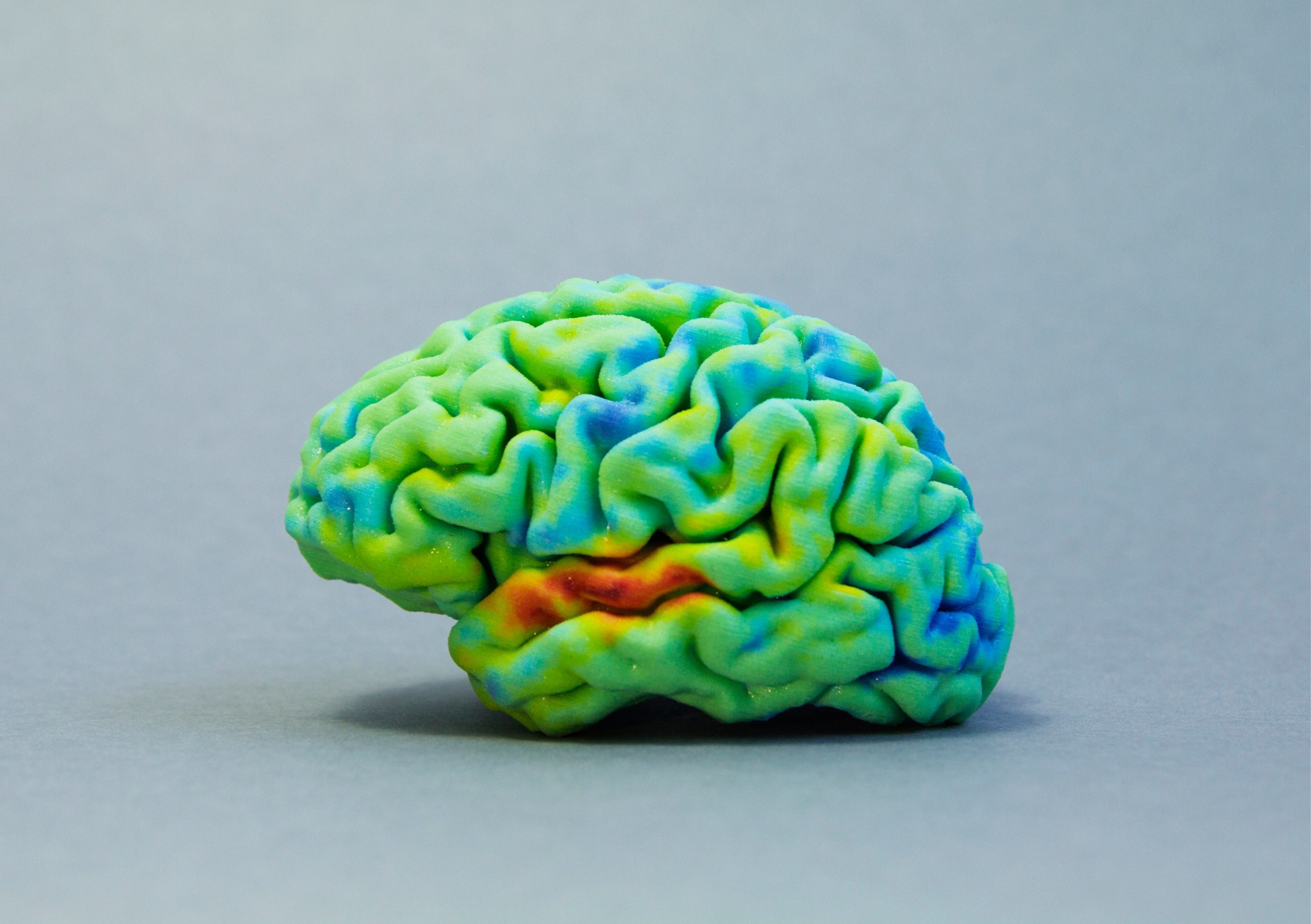 Printable 3d Brain Model