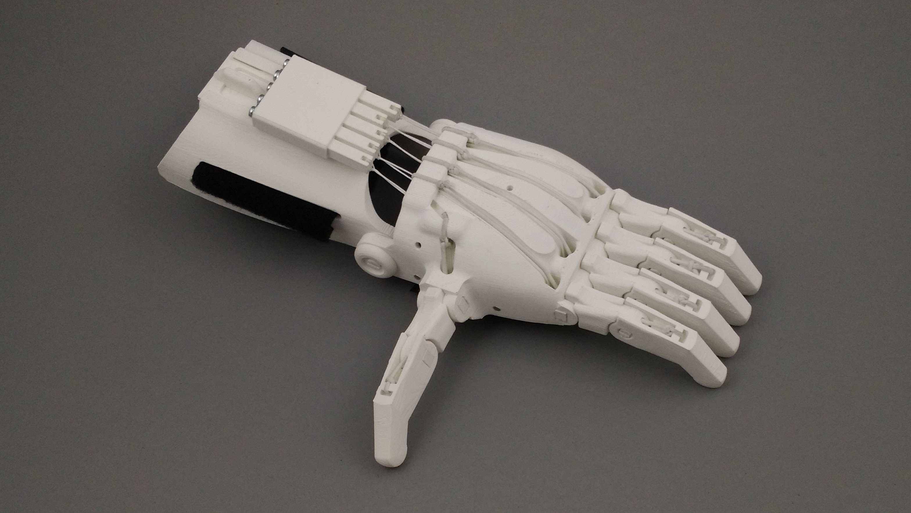Handesign makes parametric prosthetics a reality | Sculpteo Blog
