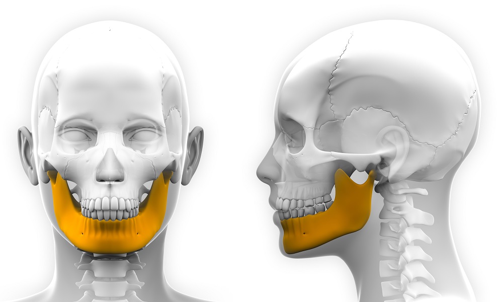 Medical 3D printing: Additive manufacturing for Jaw Reconstruction
