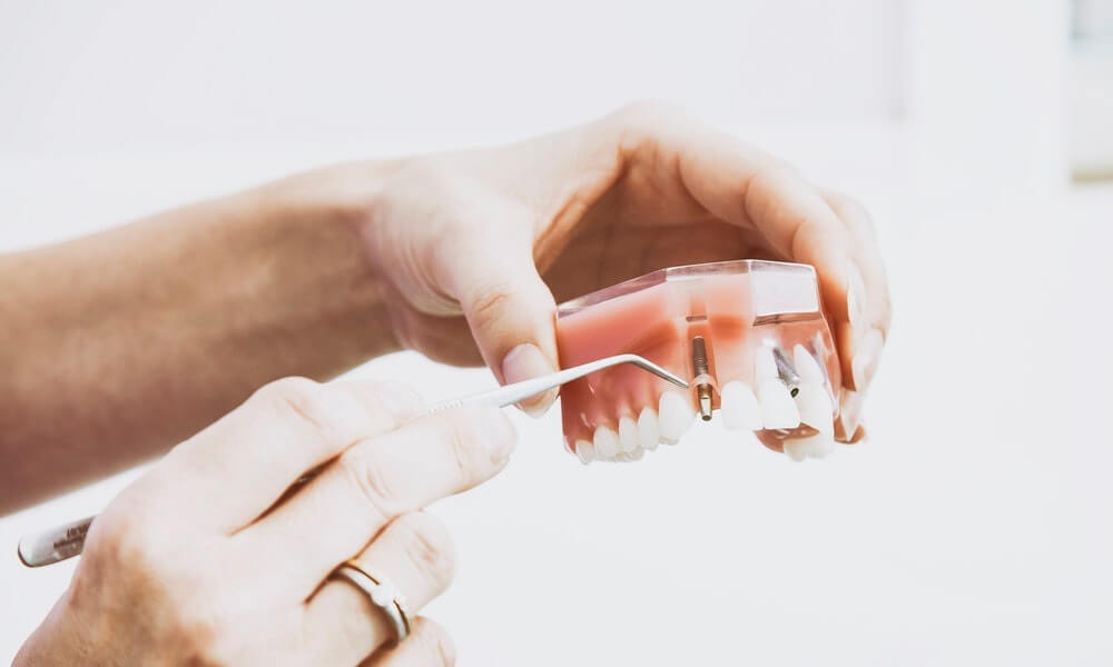 3D printing solving denture problem… in prison? | Sculpteo Blog