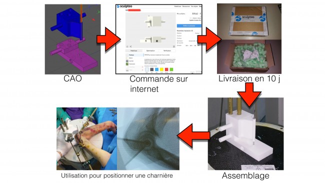 3d printed personalized surgery tools