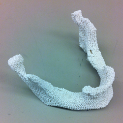 A sample 3D printed scaffold that matches the lower jaw of a female patient