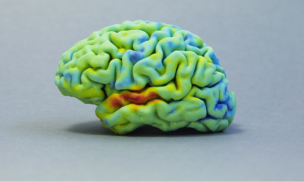 Medical 3D printing: Discover the 3D printed brain | Sculpteo Blog