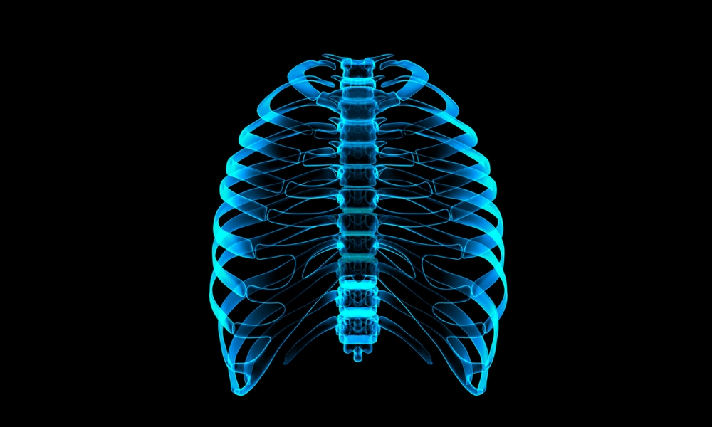 3D Printed Prosthetics: Reproducing a Rib Cage