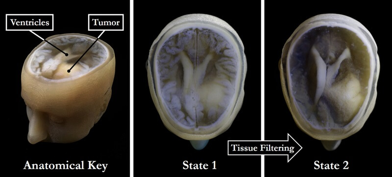 Credit: James Weaver and Steven Keating/Wyss Institute at Harvard University