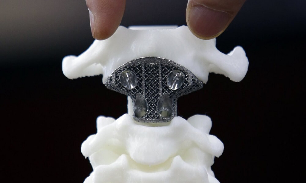 3D printed bones What is possible?