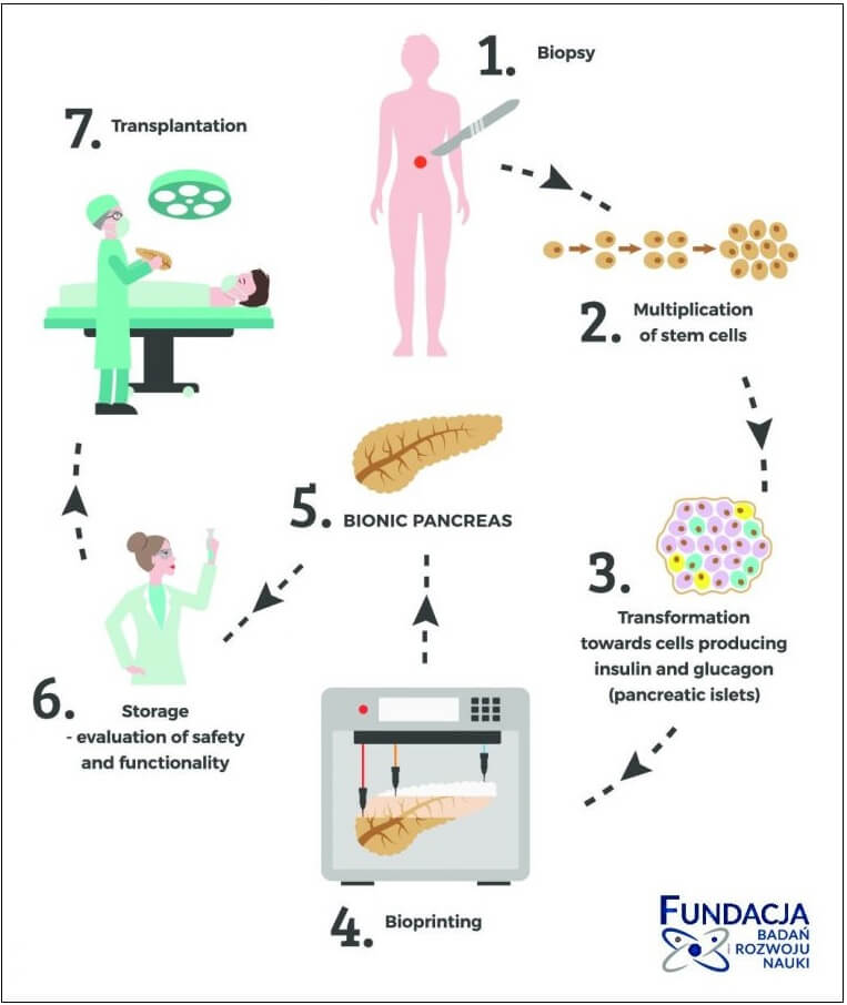 https://3dprintingindustry.com/news/poland-researchers-to-3d-bioprint-bionic-pancreas-to-combat-diabetes-151187/