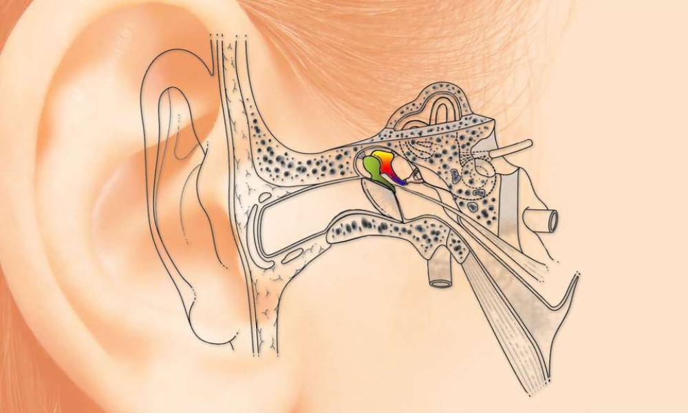 How to use 3D printing to cure deafness?