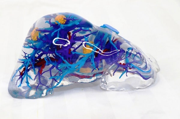 3D printed liver