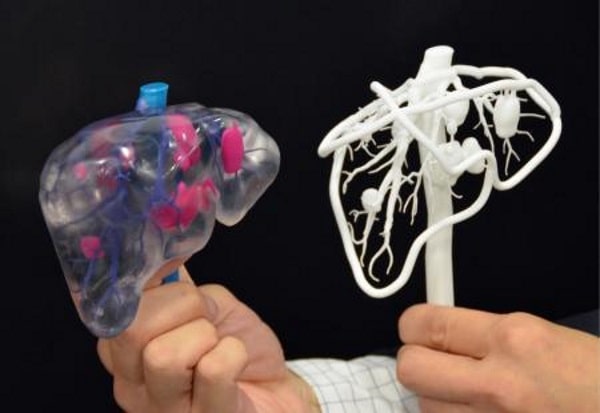 japanese-scientists-develop-3d-printed-liver-model-with-visible-blood-vessel-structures-1-min