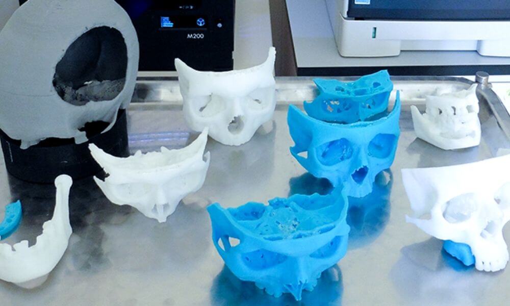 Medical & criminal 3D printing: the revolution of facial reconstruction