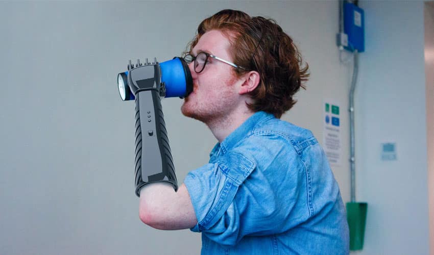 3D printed arm