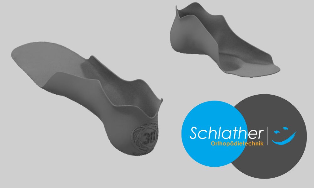 Schlather uses 3D printing to create customized medical aids | Sculpteo Blog