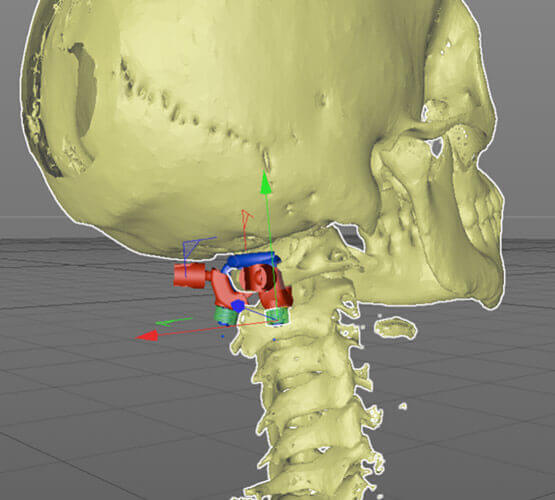 3D_printed_implant_for_the_medical_industry_isw6cPD.jpg 3D_printed_implant_for_the_medical_industry_isw6cPD.jpg