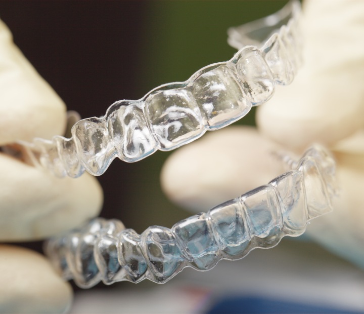 dental aligners