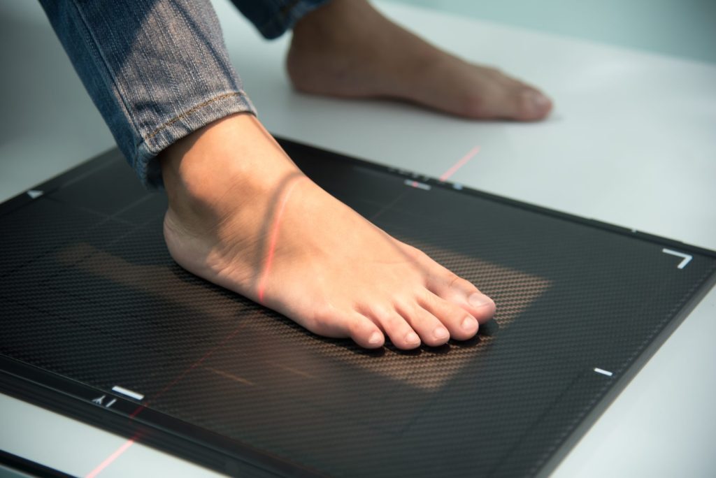 Foot Scan Insole 3D-printed orthotic insoles: Personalized comfort at your feet