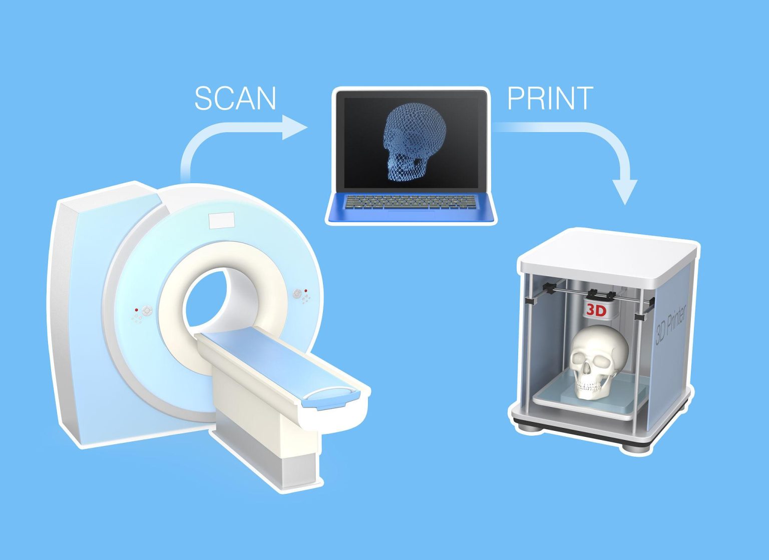 DICOM to STL: Medical Image Segmentation & Printing