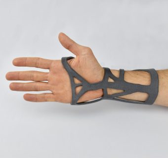 Main Hand Wrist orthèse PA11 O&P