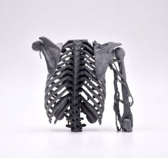 Sculpteo 3D Printed anatomic model from Slicer 3D