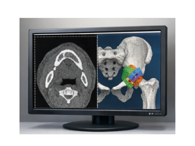 3D printed surgical guide steps