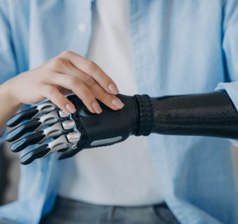 3d printed arm prosthetic bionic robotic hand technology
